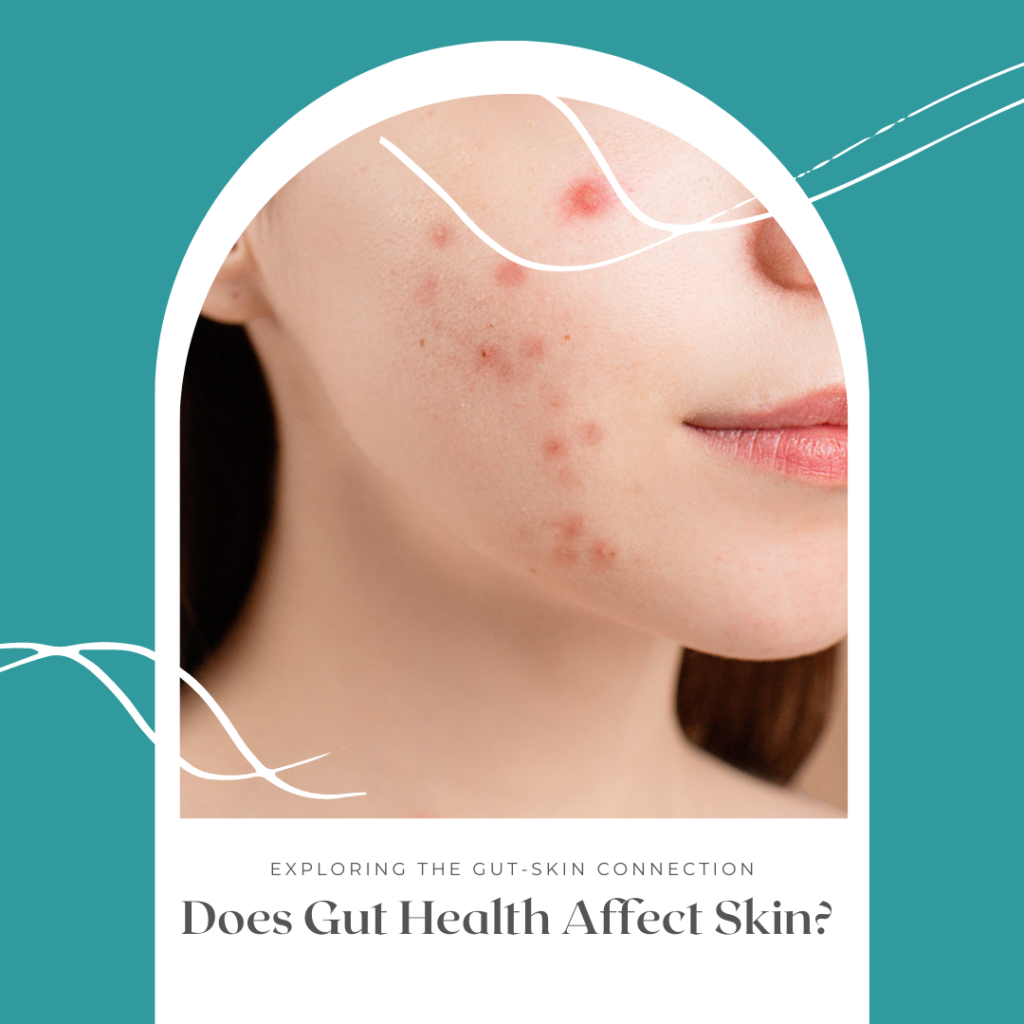 Does Gut Health Affect Skin?